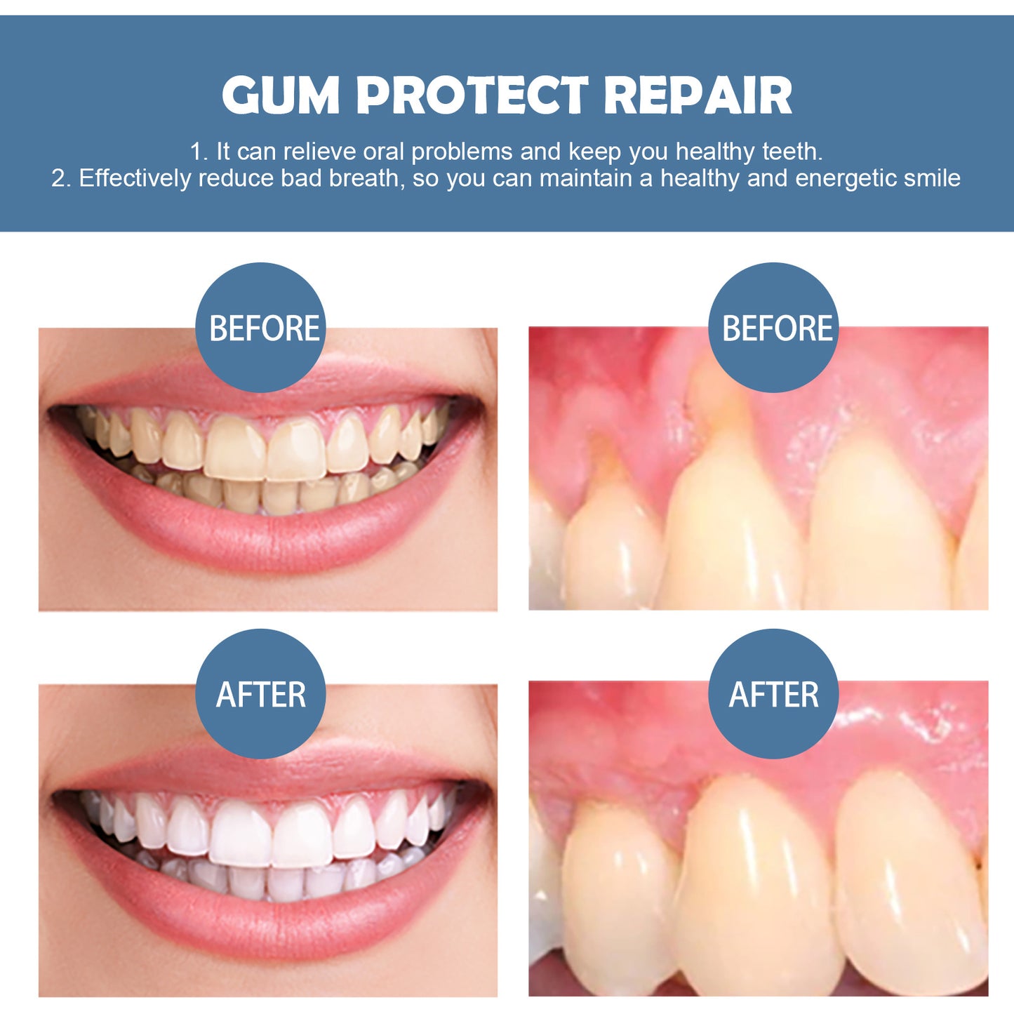 EELHOE Gum Repair Series Cleaning